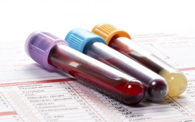 DeStress – Lower Cholesterol Naturally