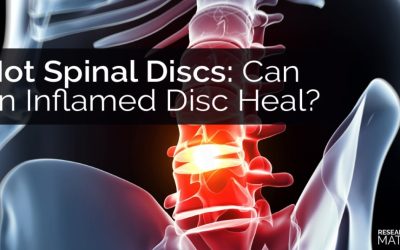 Hot Spinal Discs: Can an Inflamed Disc Heal?