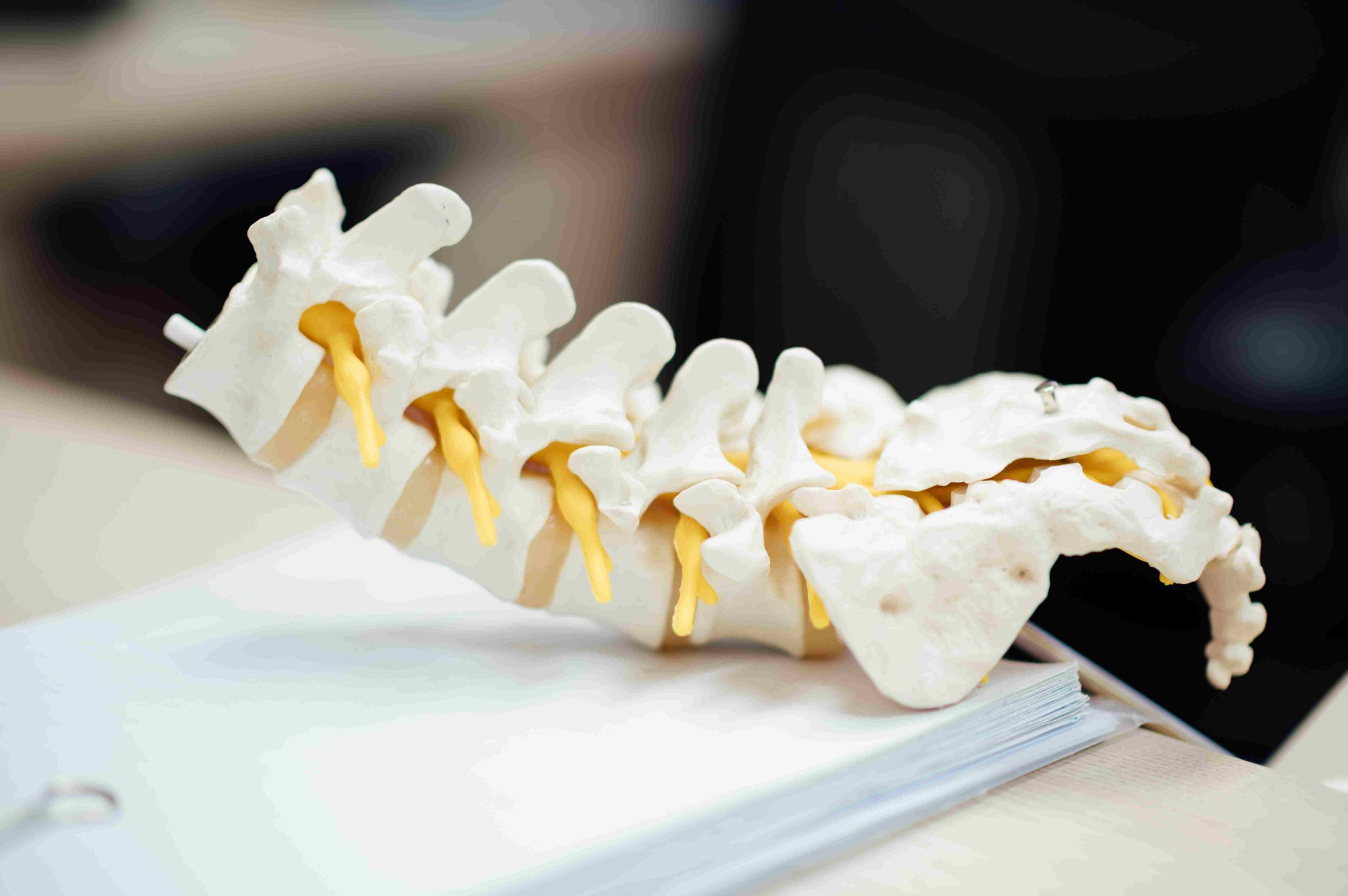 10 Lessons Learned From Injuring My Back