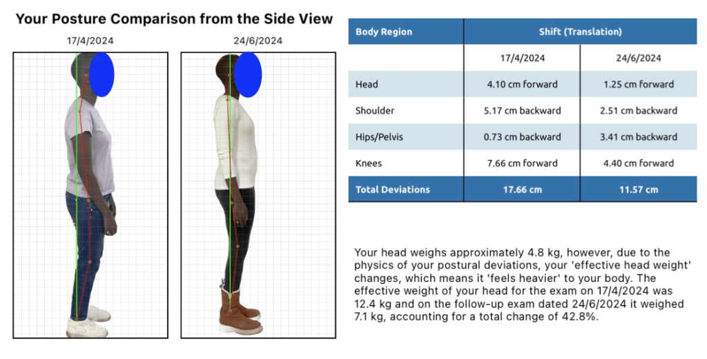 Comparing before and after posture with chiropractic care